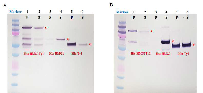 Ty1이 융합된 단백질들의 supernatant와 pellet fraction의 Western blot 분석