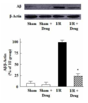 Effects of thiazole derivative drug on protein level of Aβ in ischemia/reperfusion (I/R) brain injury