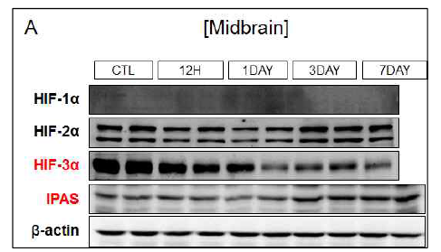 MPTP 신경독소 유도 실험모델 쥐에서 HIF-α의 발현양상 분석