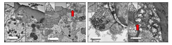 당뇨쥐의 외유모세포 및 신경연접에서 mitochondria 의 손상