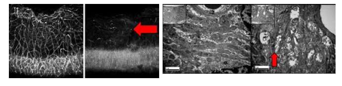 당뇨쥐의 측벽에서 뚜렷한 혈관감소와 mitochondria 의 손상