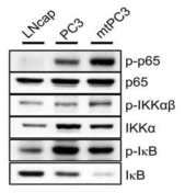골전이 전립선암의 NF-kappaB 신호 체계 활성화. LNcap, PC3 (모세포주), mtPC3 (골전이 전립선암) 세포들의 phosphorylated p65, IKKalpha, IkappaB를 Western blotting으로 확인