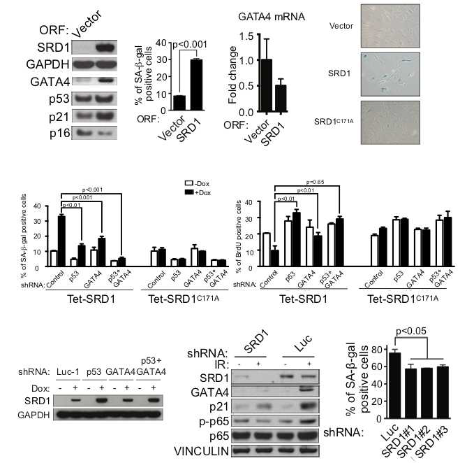 SRD1에 의한 p53 그리고 GATA4-노화연관 분비표현형 경로의 조절