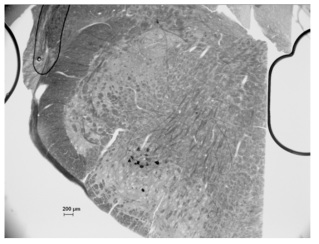 Facial nucleus