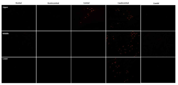 Immunohistofluorescence image. MEP (red)