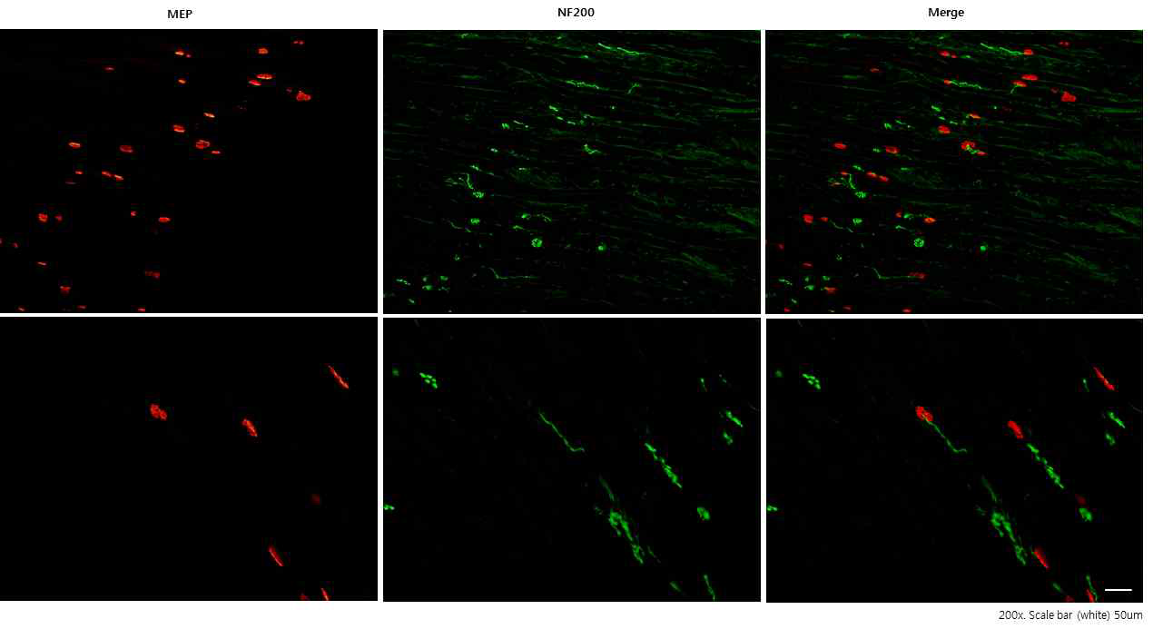 Immunohistofluorescence image. MEP (red), Axon terminal (green)