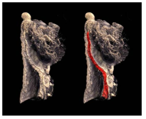 PTA 염색을 통한 3D Reconstruction image (red; orbicularis oculi)