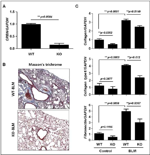 Bleomycin-induced lung fibrosis was suppressed in Crbn KO mice. A, Real-time PCR for cereblon and GAPDH in lung tissue from wild-type (WT) and Crbn KO C57BL/6 mice (n=4 per group). B-C, WT and Crbn KO mice were treated with intratracheal instillation of bleomycin (BLM, 5 U/kg) or saline on day 0. Representative photographs of lungs from WT and Crbn KO mice day 11 after intratracheal instillation of BLM or saline. Sections were stained with Masson-trichrome (B). Real-time PCR for collagen, collagen type 1, fibronectin, and GAPDH in lung tissues from WT and Crbn KO mice (C)