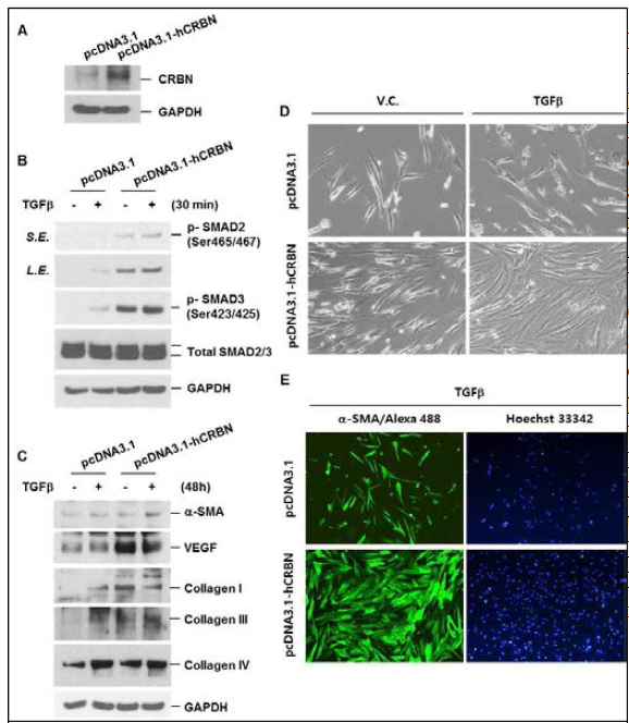 Cereblon overexpression increased TGFβ-induced activation of SMAD pathway, collagen laydown, and cell survival in human lung fibroblast. IMR-90 cells were transiently transfected with control or cereblon overexpression vectors. Forty-eight hours after transfection, cells were treated with TGFβ (10 ng/ml) for 0 min (A), 30 min (B) or 48 h (C-E). A-C, Total cellular extracts were subjected to Western blot analysis for cereblon, p-SMAD2 (Ser465/467), p-SMAD3 (Ser423/425), total SMAD2/3, α-SMA, VEGF, collagen I, collagen III, collagen IV, and GAPDH. D, Representative photographs of IMR90 cells 48 h after TGFβ treatment in control or cereblon overexpressing cells. E, Cells were fixed and permeabilized for 10 min. Immunofluorescent staining of α-SMA was performed using anti-α-SMA antibody, followed by using Alexa Fluor 488 antibody. Cells were analyzed using EVOS FL microscope. Results are representative of three independent experiments