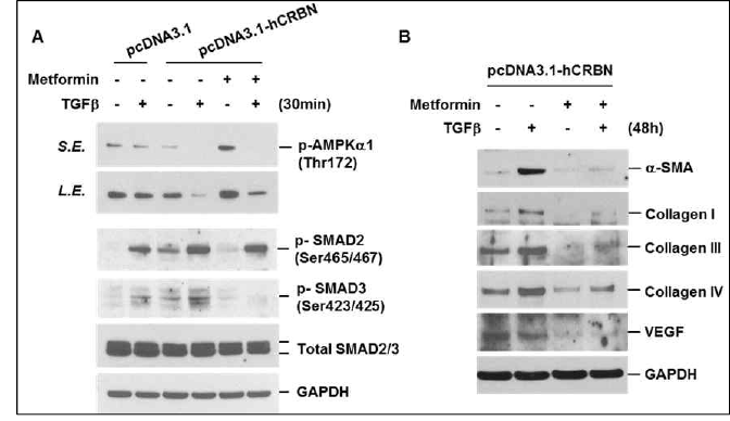 Increased TGFβ-induced activation of SMAD by cereblon overexpression was associated with inactivation of AMPK. A-B, IMR90 cells were transiently transfected with control or cereblon overexpression vectors. Forty-eight hours after transfection, cells were pre-treated with metformin (5 mM) for 1 h and then stimulated with TGFβ (10 ng/ml) in the presence or absence of metformin for the indicated times. Total cellular extracts were subjected to Western blot analysis for p-AMPKα1, p-SMAD2 (Ser465/467), p-SMAD3 (Ser423/425), total SMAD2/3, α-SMA, collagen I, collagen III, collagen IV, VEGF, and GAPDH. Results are representative of three independent experiments