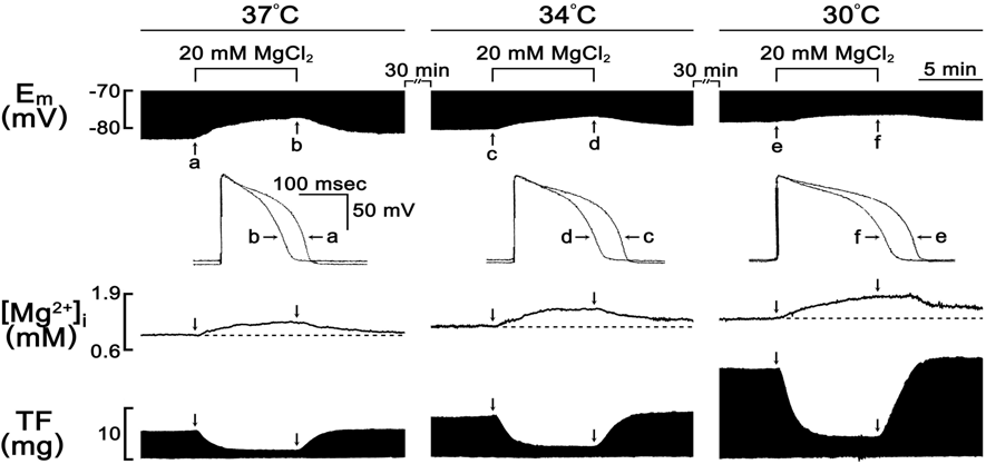 Effects of hypothermia on the high [Mg2+]o-[Mg2+]i increase in papillary muscle