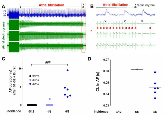 Effects of severe hypothermia on atrial fibrillation inducibility