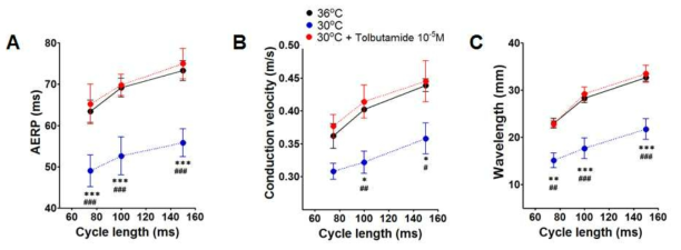 Effects of severe hypothermia on atrial electrophysiological parameters in the presence of KATP channel inhibitor(tolbutamide)