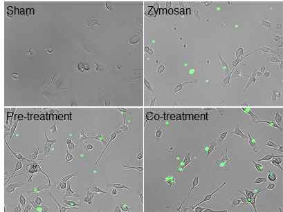 BV2에 reduced HMGB1 0.5 μg/ml을 Zymosan particle 0.5 μg/ml을 처리하기 1시간 전 또는 같이 처리한 후 live cell imaging으로 관찰함