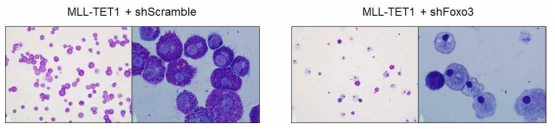 골수 전구세포에서 MLL-TET1과 Foxo3 shRNA에 의한 분화 형태