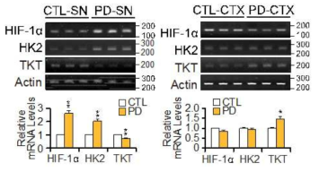 파킨슨 환자 중뇌흑질 및 대뇌피질에서 HIF-1α, HK2, TKT 유전자의 mRNA 전사 수준 확인 및 정량 (PD 환자 중뇌, 대뇌피질)