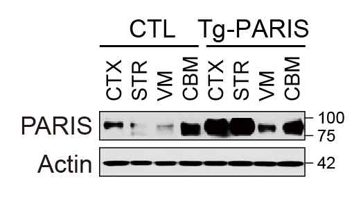 PARIS 형질전환마우스의 대뇌 피질, 선조체, 흑질, 소뇌에서 PARIS 발현량 확인
