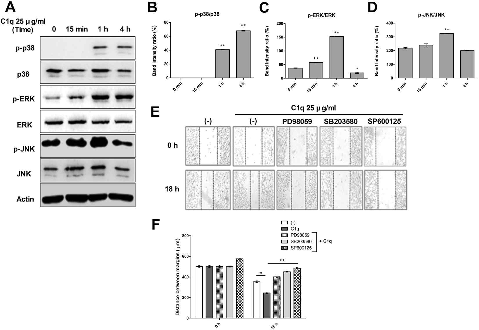 C1q enhanced MAPKs signaling in HepG2 cells. After treating HepG2 cells with or without C1q for the indicated times, the expressions of the phosphorylated and total forms of p38, ERK1/2, and JNK were evaluated by western blotting (A). Bar graphs represent the following ratios; p-p38/p38 (B), p-JNK/JNK (C), and p-ERK1/2/ERK1/2 (D). Cells were pretreated with MAPKs inhibitors (20 μM each) for 1 h, then monolayers were scratched, and then treated with or without C1q. Photographs were taken after treatment for 0 or 18 h (E).The bar graph shows migration distances (F). *P < 0.05, **P < 0.01