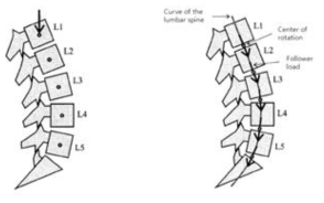 척추의 follower load