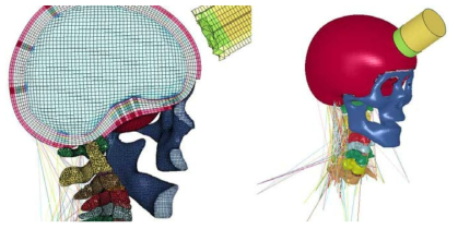 LS-DYNA를 이용한 뇌-경추 충격 시뮬레이션