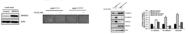 ZNF857A 과발현 폐암 세포 제조 및 TGF-β1에 의한 EMT 현상에서 ZNF857A의 억제 역할