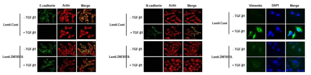 TGF-β1에 의한 EMT 조절 현상에서 ZNF857A의 억제 역할