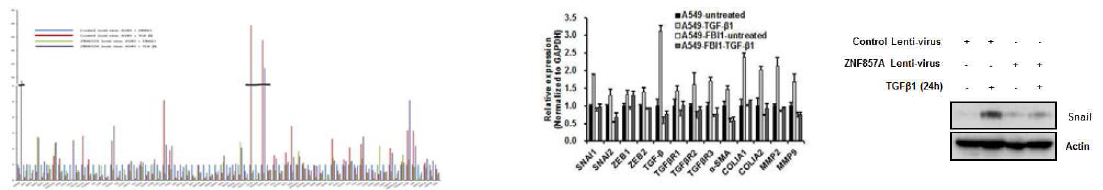 ZNF857A에 의한 E-cadherin 전사 억제제인 snail의 발현 및 EMT 관련 인자 억제