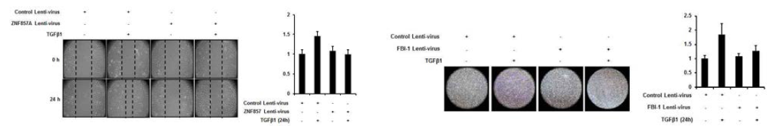 TGF-β1에 의한 A549 세포의 이동 및 침윤 현상에서 ZNF857A에 의한 억제 효과