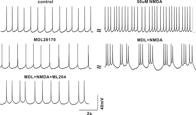 calpains 억제 후 NMDA (50uM)반응에서 bursting 과 유사한 전기적 신호를 보여주고 있다. 같은 세포에 TRPC4 blocker함께 처리한 결과 burst patterns이 사라진다. calpains 활성은 TRPC4차단으로 이어지기 때문에 세포내 calpains활성을 억제해 주면 TRPC4의 작용을 통해 세포의 firing patterns을 조절 할 수 있음을 시사 할 수 있다