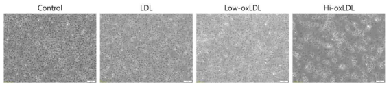 저밀도 지질단백질의 산화 정도에 따른 혈소판 활성 변화. 산화 정도가 큰 저밀도 지질단백질을 처리하였을 때, 혈소판의 활성지표 중 하나인 혈소판 응집이 크게 증가한 것을 관찰할 수 있었다. 반면 산화되지 않거나 산화 정도가 작은 저밀도 지질단백질은 혈소판 응집을 유도하지 못했다