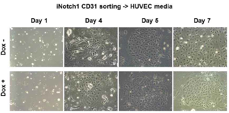 Embryoid body 분화 6일차에서 분리된 CD31 세포의 배양 모습