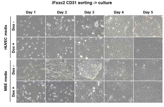 Embryoid body 분화 6일차에서 분리된 CD31 세포의 배양 모습