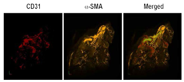 마우스 하지허혈 유도 후 CUBIC을 통한 조직투명화 적용 후 immunolabeling에 의한 3D 이미지