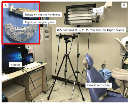 치과 임플란트를 위한 동적 내비게이션 수술장비 시제품
