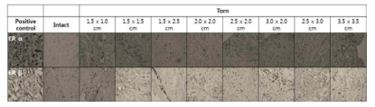 Estrogen receptor α 및 β의 회전근 개 건조직 면역화학 염색소견