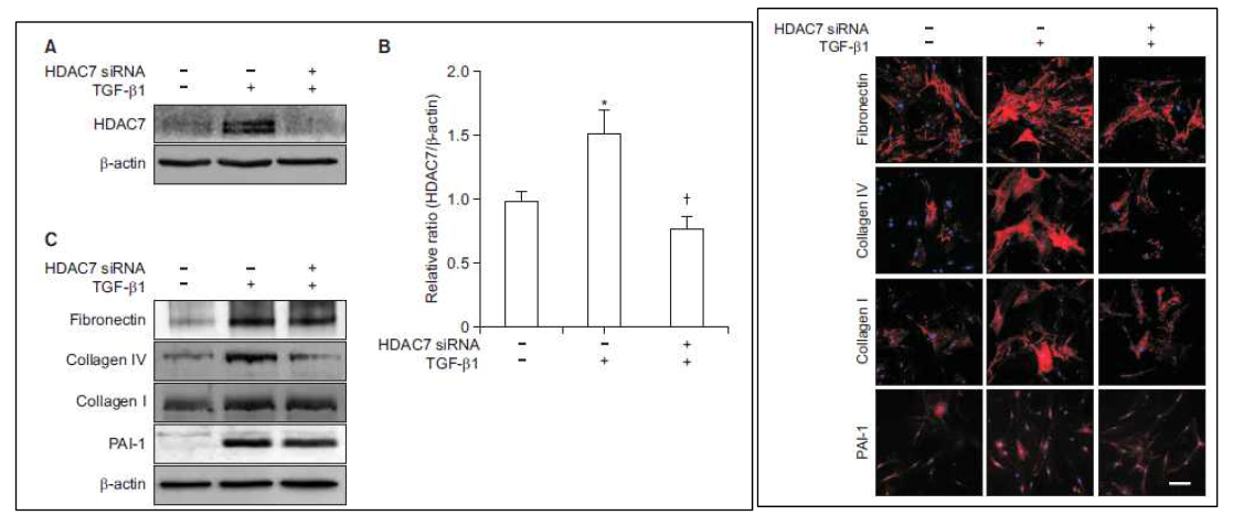 HDAC7 siRNA 처리 후 TGF-β1으로 유도된 HDAC7이 효과적으로 억제됨을 확인하였고, HDAC7 발현을 억제시킴으로써 섬유화와 관련된 ECM molecule들의 발현이 효과적으로 억제됨을 확인함