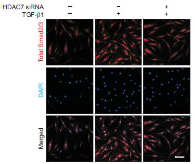 TGF-β1 처리 후 total Smad2/3 분자가 핵안으로 이동함. HDAC7 siRNA로 HDAC7의 발현을 억제한 군에서는 smad2/3가 핵안으로 이동하는 translocation 과정을 효과적으로 차단시키는 것을 확인함