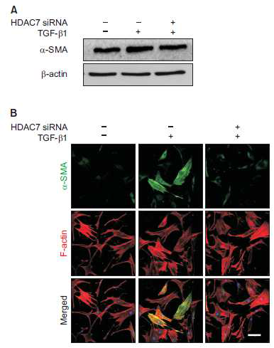 음경만곡증 환자의 섬유화병변에서 분리된 섬유모세포에 HDAC7 siRNA 처리 후, HDAC7의 knockdown을 유도함. HDAC7 siRNA 투여 후에는 α-SMA protein 발현이 약간 감소됨을 확인하였음. HDAC7 억제 시 myofibroblast로의 전이 (transition)가 억제됨을 확인함