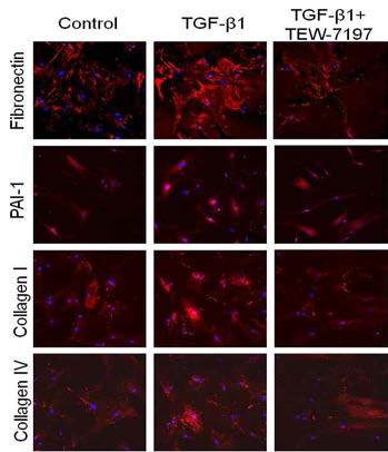 음경만곡증 환자의 섬유화병변에서 분리된 섬유모세포에서 TEW-7197 처리 후, ALK5의 저해를 유도함. 이에 면역형광염색을 통해 TGF-β1 신호전달에 의한 extracellular matrix protein (ECM)의 합성증가를 성공적으로 억제함