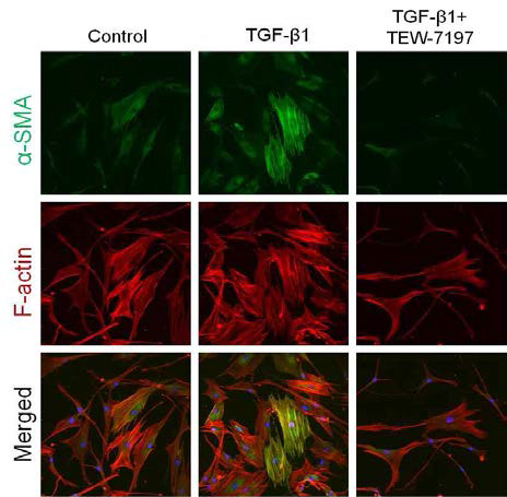Phalloidin을 사용하여 세포의 F-actin (actin의 filament 염색)을 염색. α-SMA을 이용하여 fibroblast에서 myofibroblast로 전이됨을 확인함. TGF-β1 처리 시 α-SMA가 증가, TEW-7197 동시 처리군에선 α-SMA 발현양이 감소됨을 확인하였음. 결론적으로 TEW-7197이 myofibroblast로의 전이(transition)를 억제함