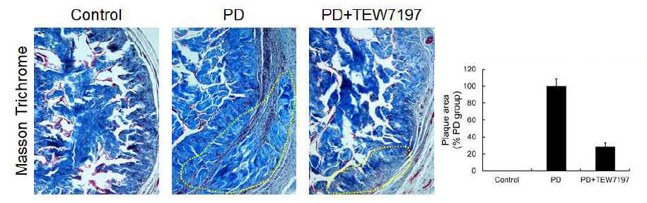 Masson‘s Trichrom stain (MT 염색). 정상대조군에 비해 음경만곡증 유도 모델에서 섬유화경결의 범위가 현저하게 증가하였고, TEW-7197 투여군에서는 정상 대조군과 유사한 수준으로 섬유화병변이 현저하게 감소함