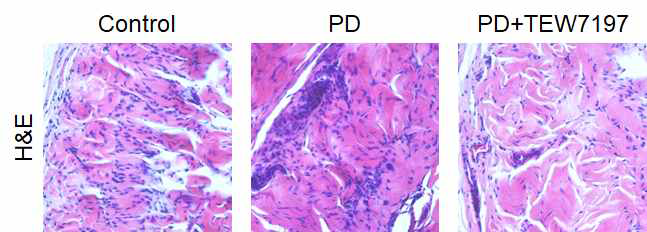 Hematoxylin and eosin stain (H&E 염색). 정상대조군에 비해 음경만곡증 유도 모델에서 lymphocyte infiltration이 증가하였고, TEW-7197 투여군에서는 정상 대조군과 유사한 수준으로 감소함