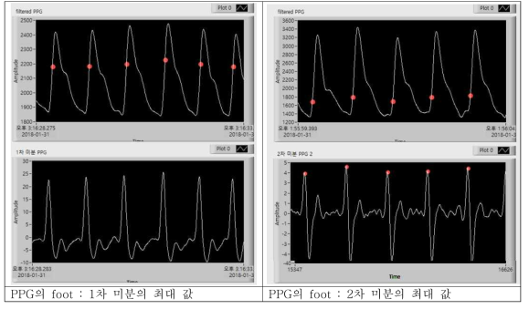 PPG 신호와 1차, 2차 미분 후의 신호