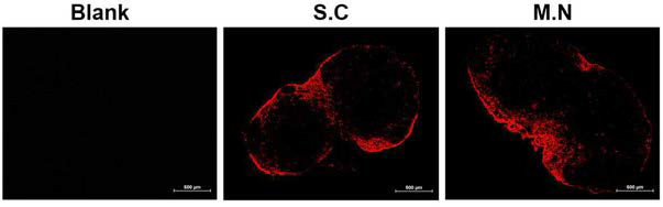 마이크로니들의 상피 전달 후 소수성 형광프로브(DiD)를 포접한 자가조립 나노입자의 림프노드 이동 (림프절 이미지)