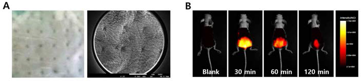 (A) 박피된 쥐 상피에 마이크로니들 적용 후 피부 구조 (광학현미경 및 주사전자현미경 이미지); (B) 소수성 형광물질(DiD)이 담지된 마이크로니들을 마우스 상피에 30분간 투여 후 in vivo 광학이미징 장비를 이용하여 시간에 따른 형광의 상피내 분포 관찰 결과