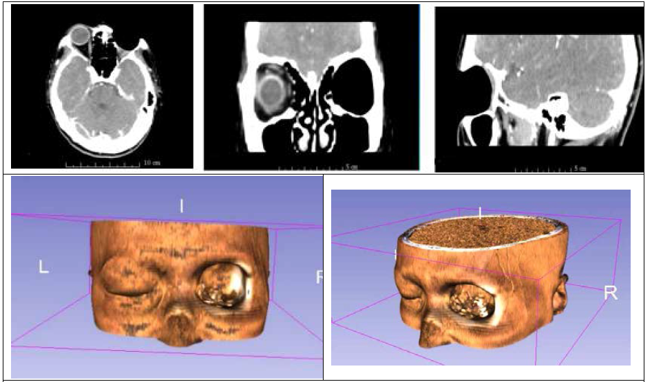 CT(Computed tomography)를 이용한 스캔데이터