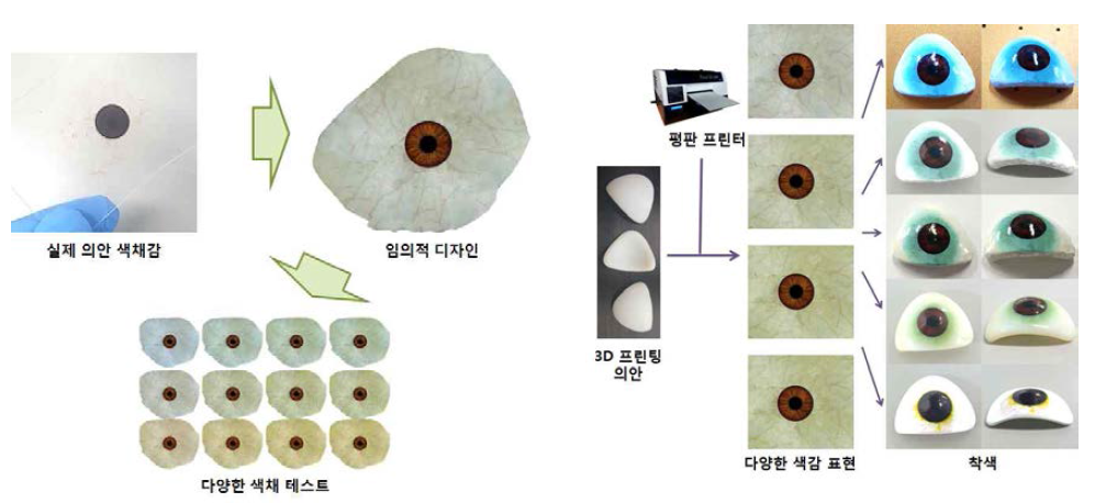 평판 프린터를 이용한 Resin 의안의 색감에 따른 적용 가능성 테스트