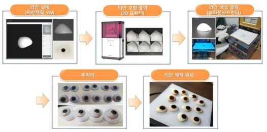 3D 프린터로 제작한 환자 맞춤형 의안 제작 기술