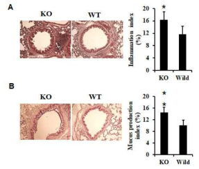 miR-150 deficiency에 의한 페조직 손상의 심화