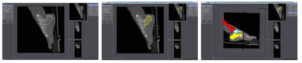 Seg3D 프로그램을 이용한 CT사진의 3D 이미지화 작업